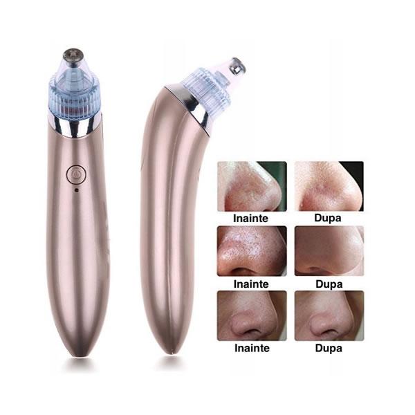 Aparat cu vacuum pentru curatarea tenului in profunzime